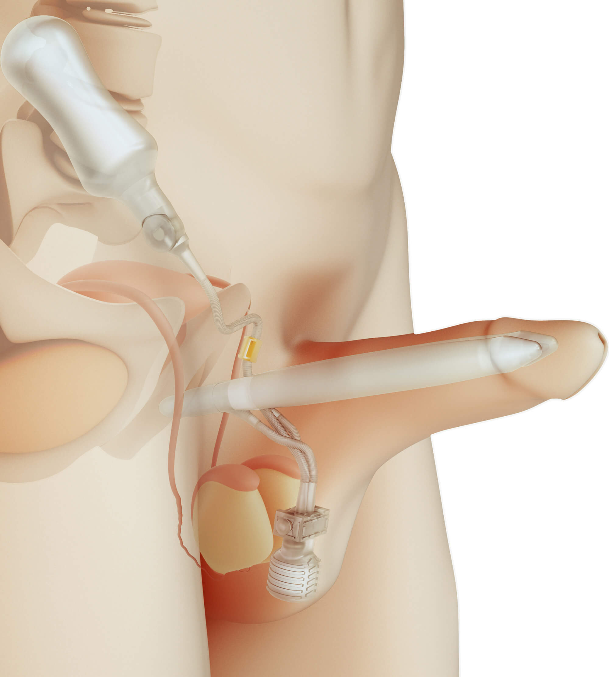 &Uuml;&ccedil; Par&ccedil;alı Şişirilebilir Mutluluk &Ccedil;ubuğu (Şişirilmiş Hali)