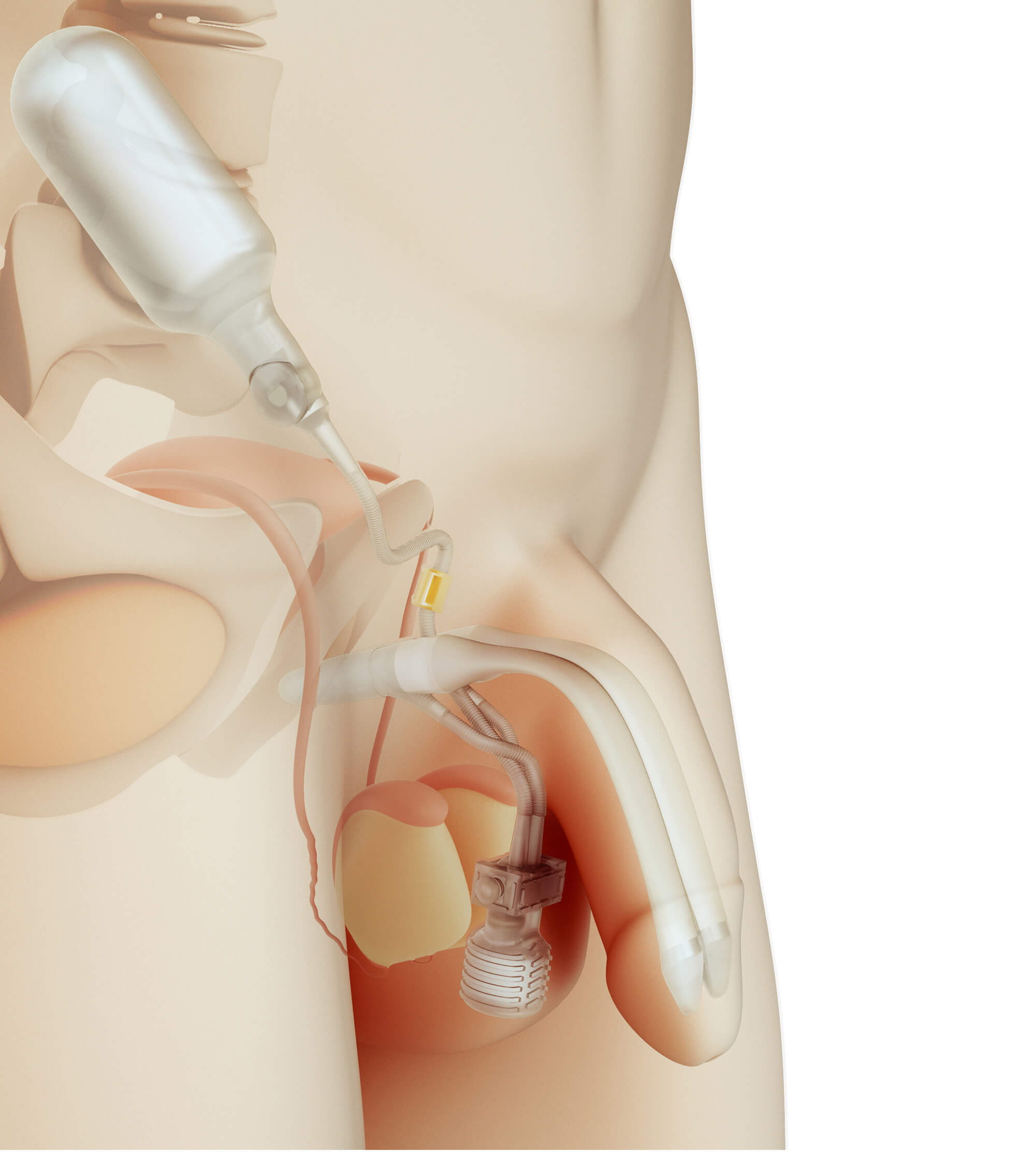 &Uuml;&ccedil; Par&ccedil;alı Şişirilebilir Mutluluk &Ccedil;ubuğu (S&ouml;nm&uuml;ş Hali)
