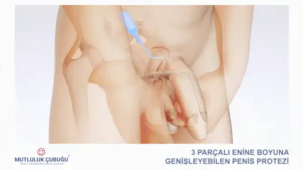 Mutluluk &Ccedil;ubuğu Animasyonu