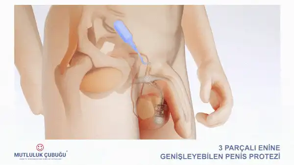 Mutluluk &Ccedil;ubuğu Animasyonu