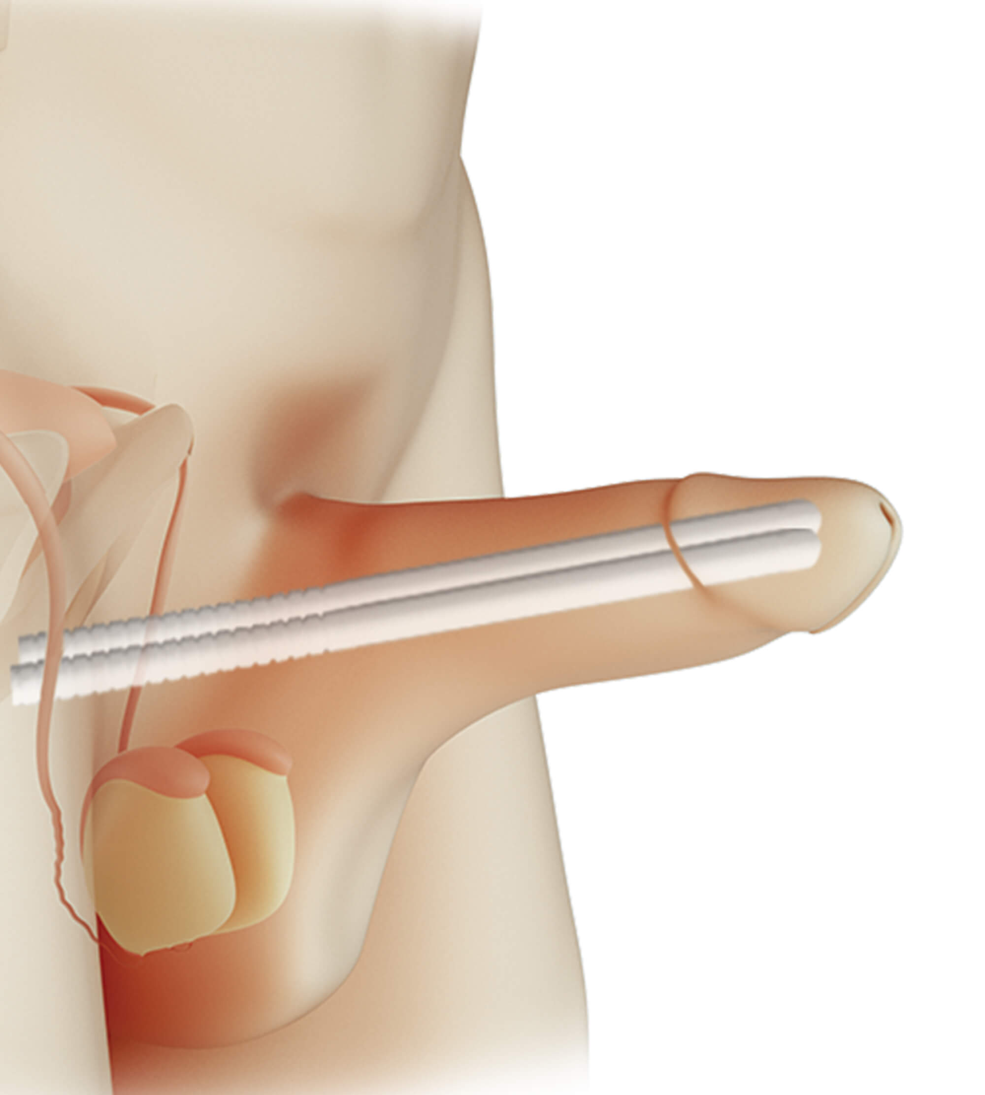 Tek Par&ccedil;alı B&uuml;k&uuml;lebilir Mutluluk &Ccedil;ubuğu